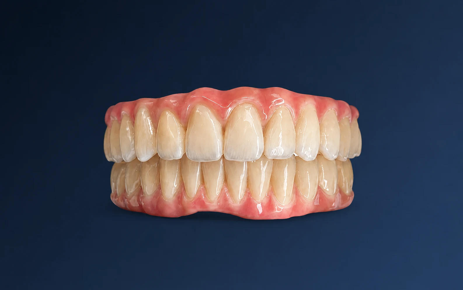 Estructura rehabilitadora Full Arch sobre implantes en zirconio fresado en el laboratorio Digitalis